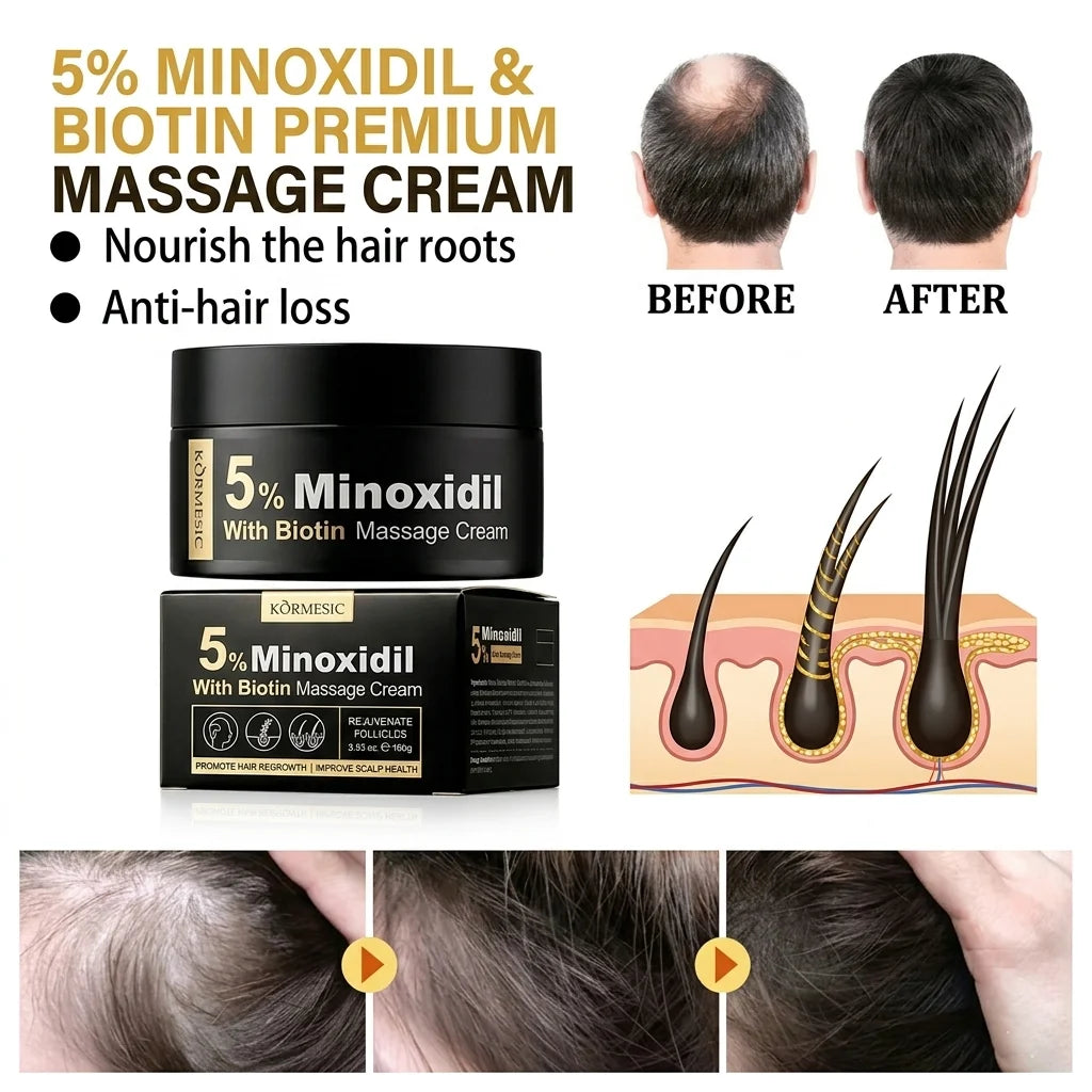 KÖRMESIC 5% Minoxidil Scalp Massage Cream