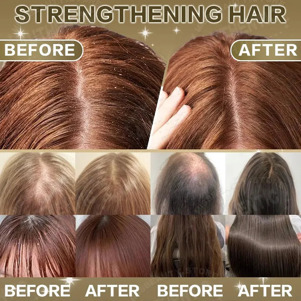 KÖRMESIC 5% Minoxidil Scalp Massage Cream
